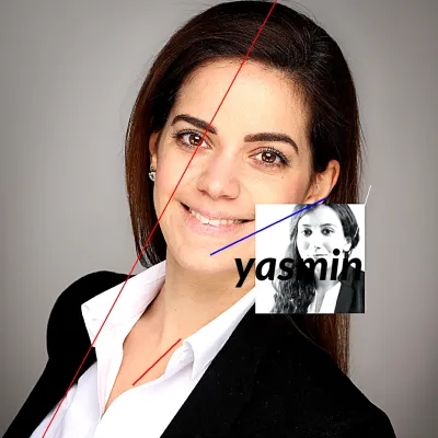 Yasmin contraceptive prix